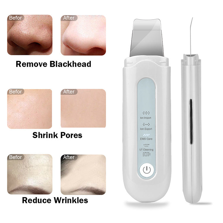 Ultrasonic Peeling Cleaner Blackhead Machine